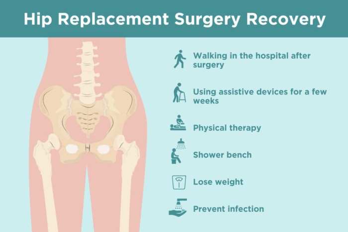 What i wish i knew before hip replacement surgery