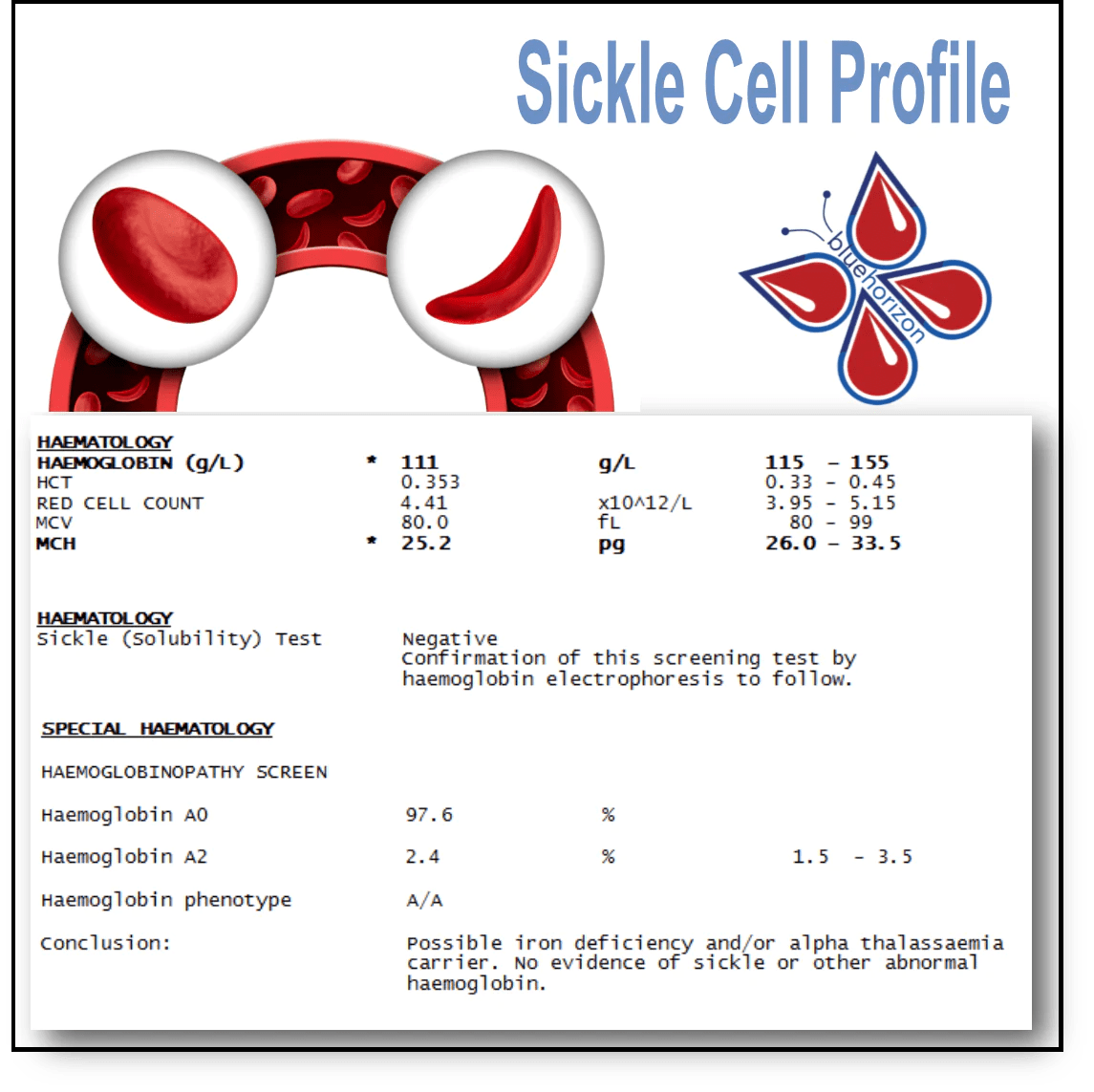 Where to get a sickle cell test near me