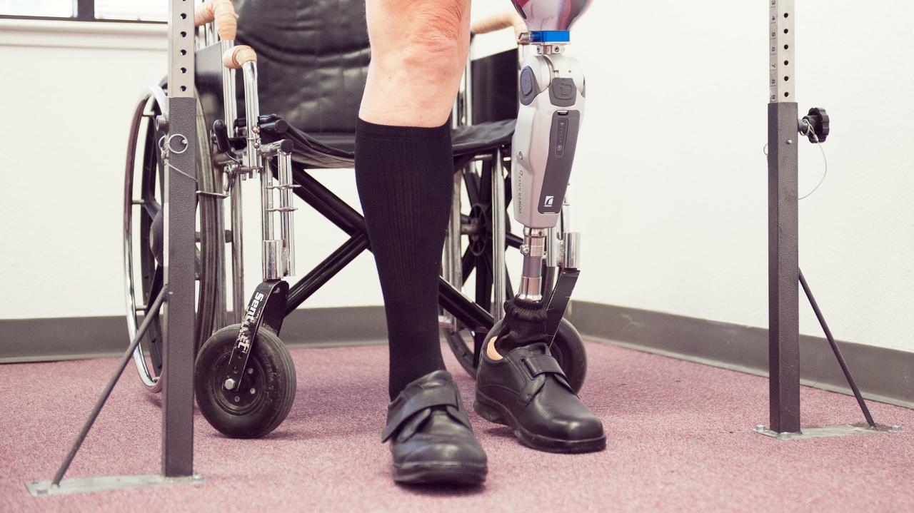 Ability prosthetics & orthotics inc