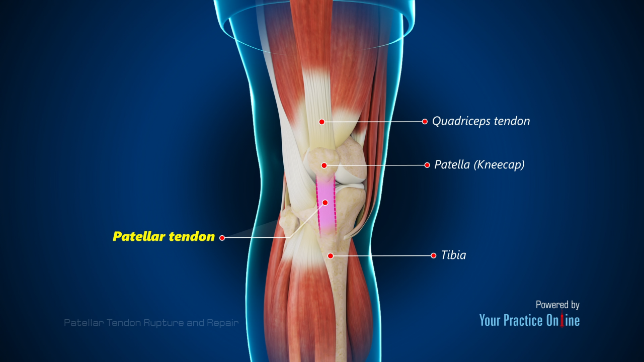 Cpt code for patellar tendon repair