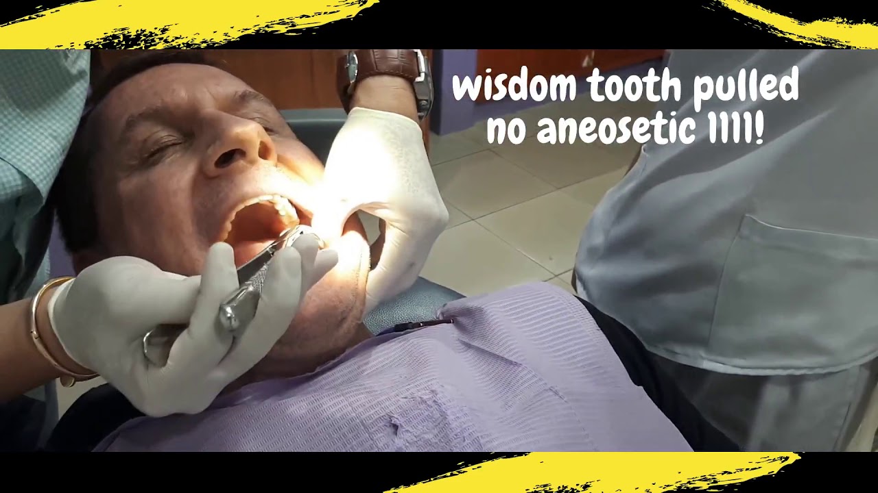 How bad is wisdom teeth removal without anesthesia